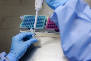 Prueba de COVID -19 en saliva, nueva apuesta de Univalle